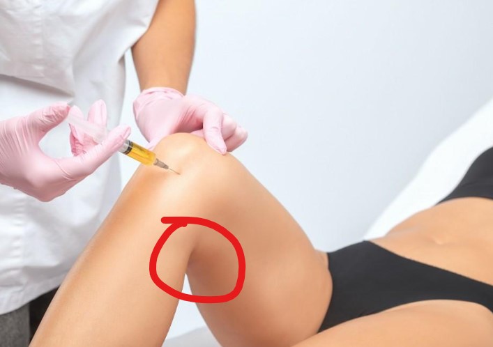 knee joint pain