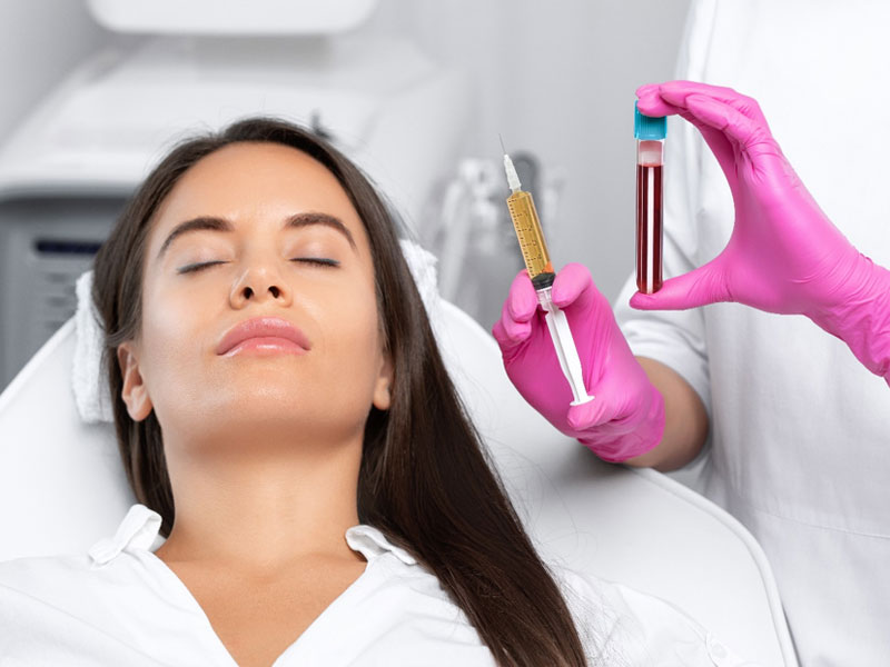 PLATELET RICH PLASMA
